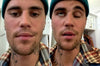 Justin Bieber affected by a rare syndrome, half his face paralyzed